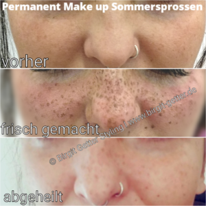 Sommersprossen-Tattoo-Permanent-Make-up-FakeFreckles-Duesseldorf-Bilk